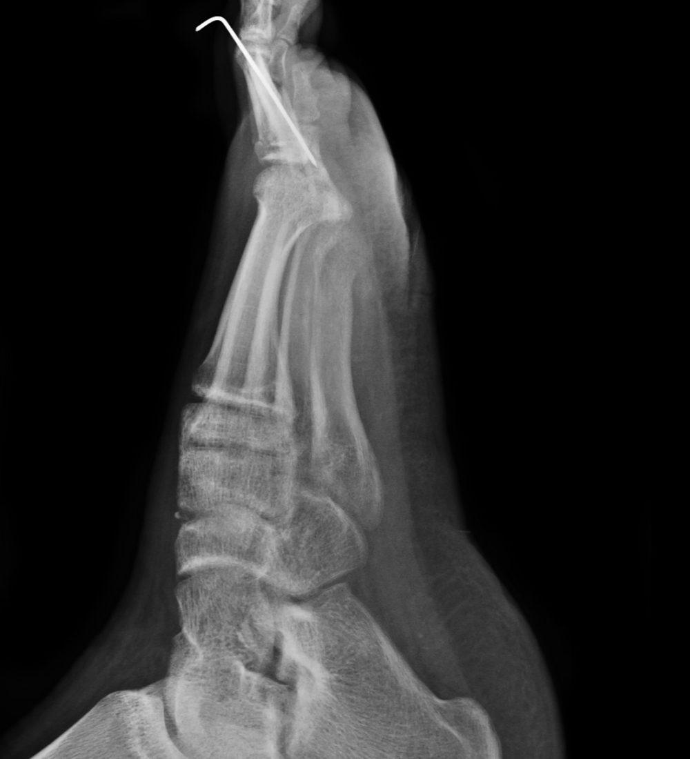 x-ray of foot, x-ray film