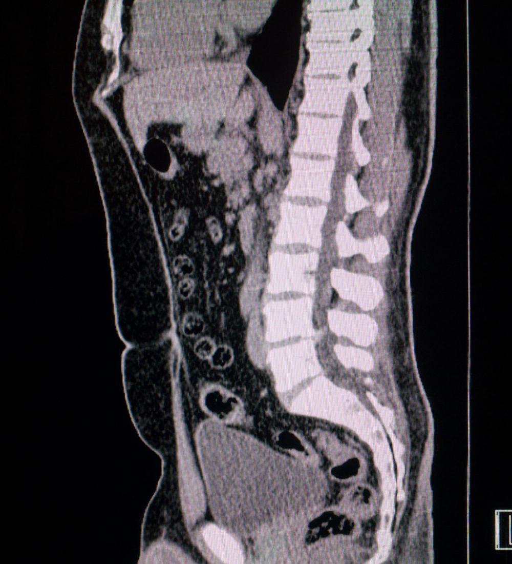 A stock photo of a CT Scan. Photographed using the Canon EOS 1DX Mark II. Perfect for designs or articles about health care,ct scans, health insurance or medical technology.