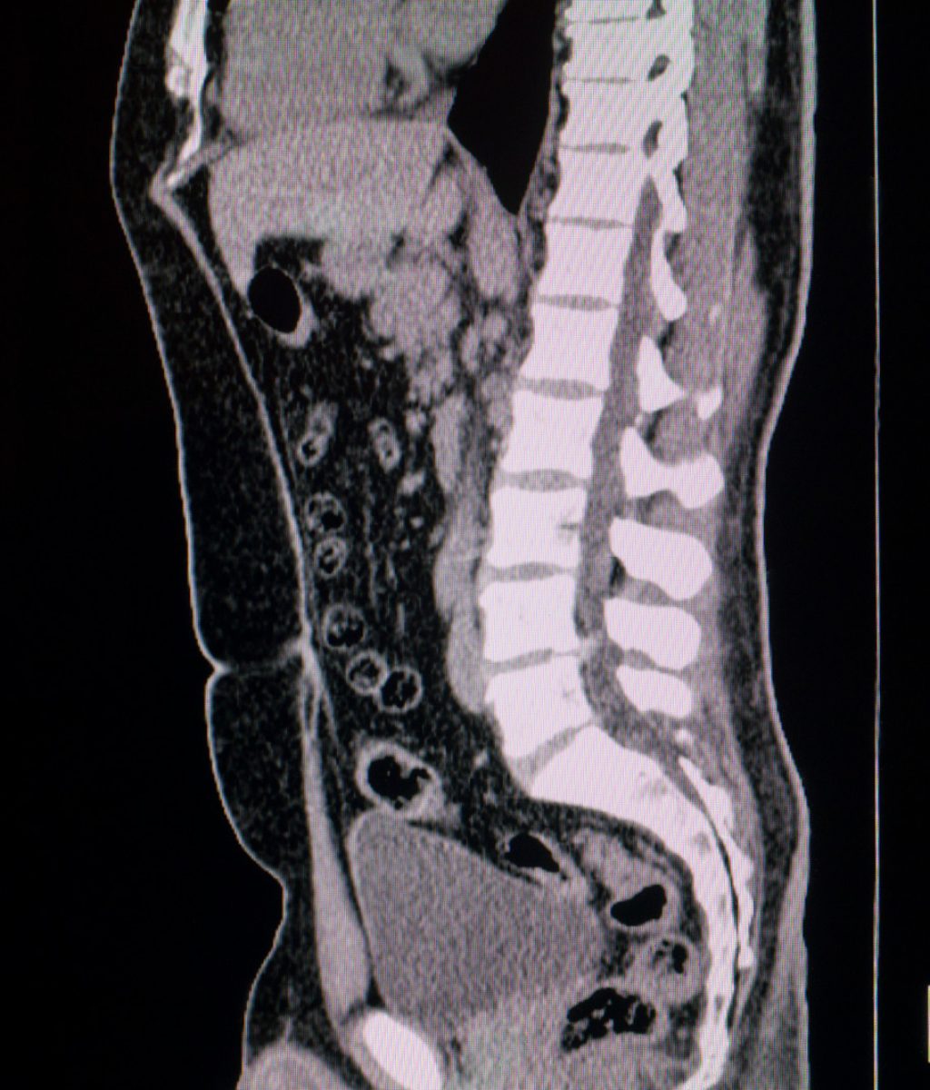 A stock photo of a CT Scan. Photographed using the Canon EOS 1DX Mark II. Perfect for designs or articles about health care,ct scans, health insurance or medical technology.