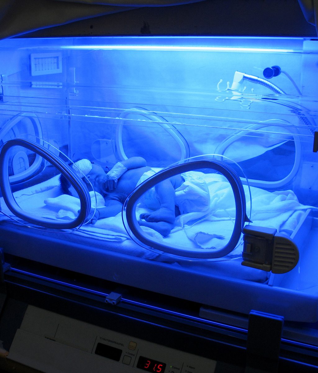 10 days old, ill little girl under UV lamp. See more this series::::